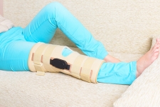 What to Expect After Knee Replacement Surgery