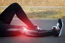 What to Know About an ACL Tear