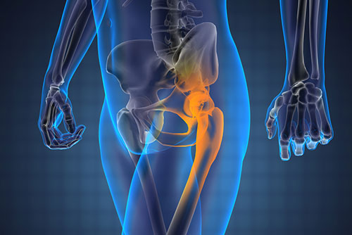 Common Causes of Hip Pain